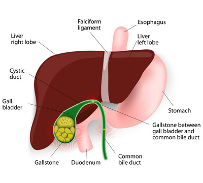 Gallbladder stone specialist in Hyderabad Illustration of gallbladder for the awareness of the patients by gallbladder stone specialist in Hyderabad